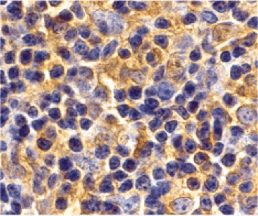 Immunohistochemistry: UBE2N/Ubc13 Antibody - BSA Free [NBP1-76593] - Immunohistochemistry of UBE2N/Ubc13 in mouse thymus tissue with UBE2N/Ubc13 antibody at 2 u/mL.