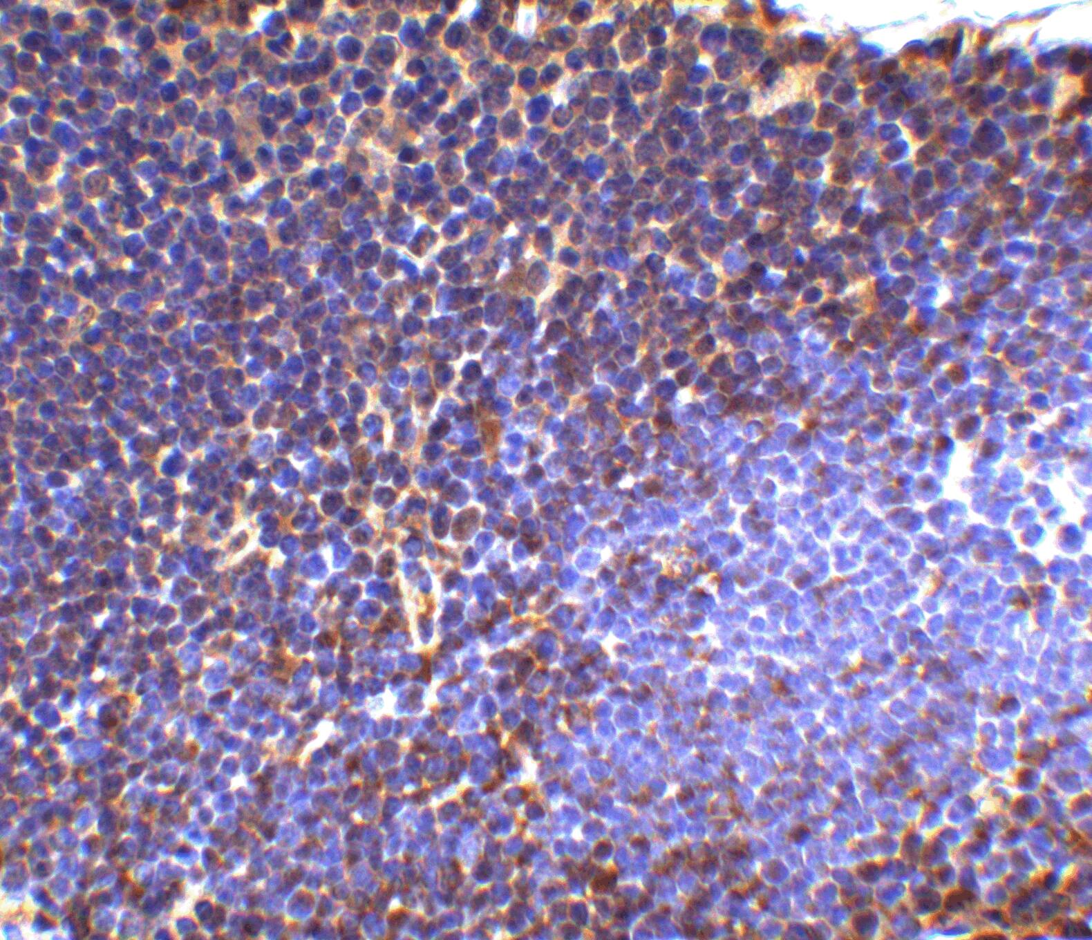 Immunohistochemistry: UBE2N/Ubc13 Antibody - BSA Free [NBP1-76593] - Immunohistochemistry of UBE2N/Ubc13 in mouse thymus tissue with UBE2N/Ubc13 antibody at 2.5 u/ml.