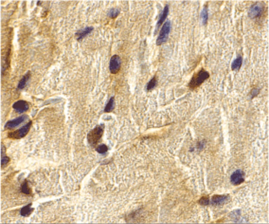 Immunohistochemistry: ECSIT Antibody - BSA Free [NBP1-76594] - Immunohistochemistry of ECSIT in mouse heart cells with ECSIT antibody at 2 u/mL.