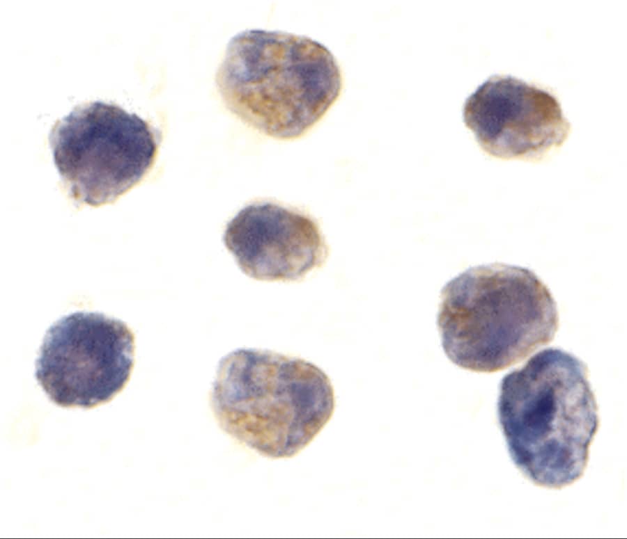 Immunocytochemistry/ Immunofluorescence: TAB1 Antibody - BSA Free [NBP1-76595] - Immunocytochemistry of TAB1 in K562 cells with TAB1 antibody at 1 ug/mL.