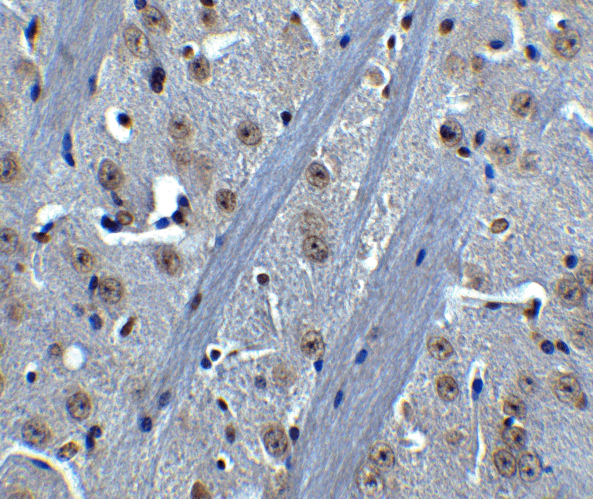 Immunohistochemistry: BTK Antibody - BSA Free [NBP1-76596] - Immunohistochemistry of BTK in mouse brain tissue with BTK antibody at 5 ug/mL.