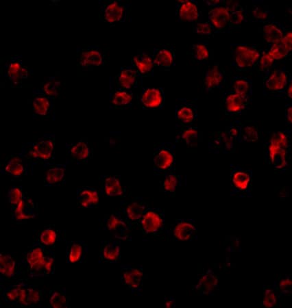 Immunocytochemistry/ Immunofluorescence: BTK Antibody - BSA Free [NBP1-76596] - Immunofluorescence of BTK in Daudi cells with BTK antibody at 10 ug/mL.