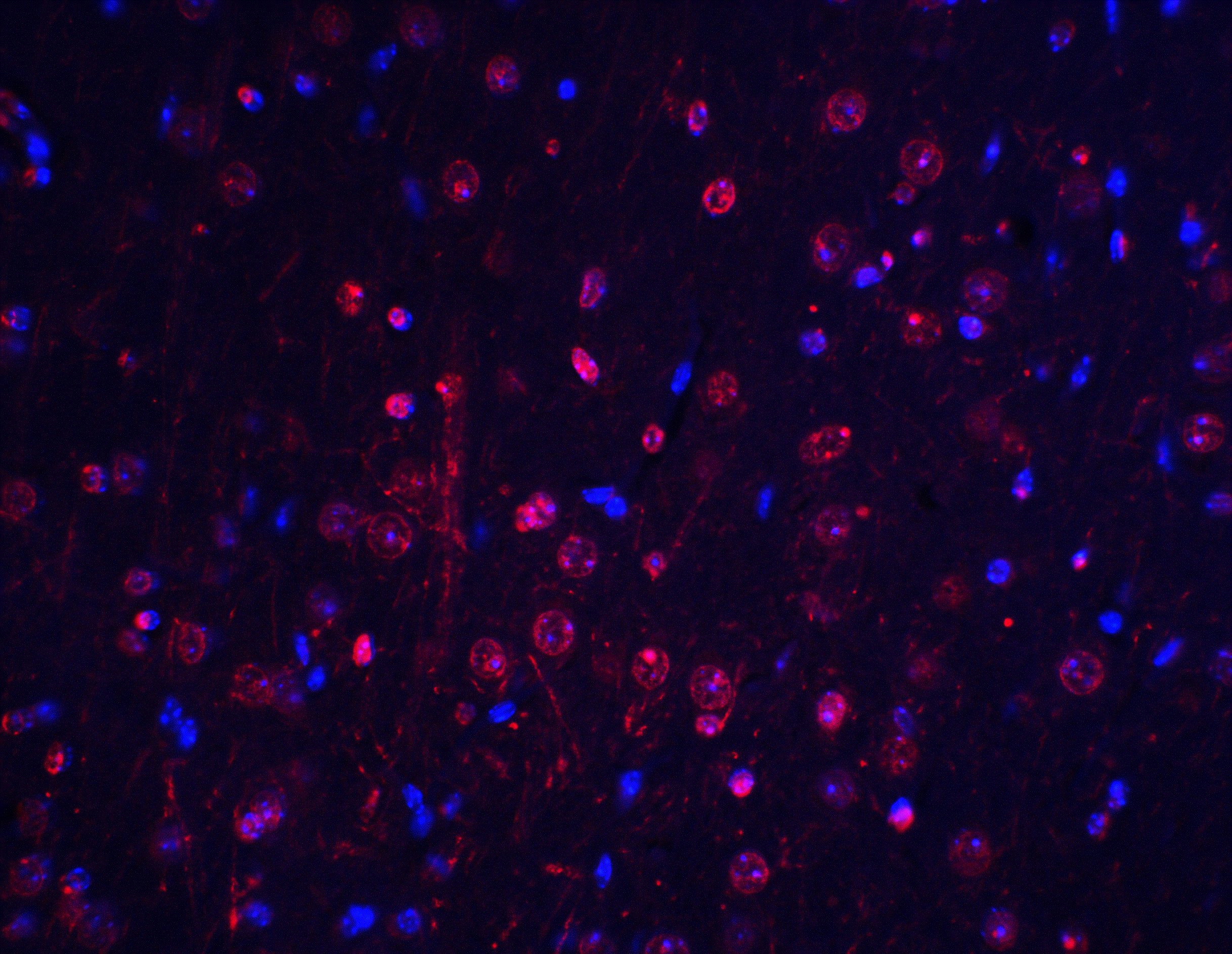 Immunocytochemistry/ Immunofluorescence: BTK Antibody - BSA Free [NBP1-76596] - Immunofluorescence of BTK in mouse brain tissue with BTK antibody at 20 ug/ml.Red: BTK Antibody   Blue: DAPI staining