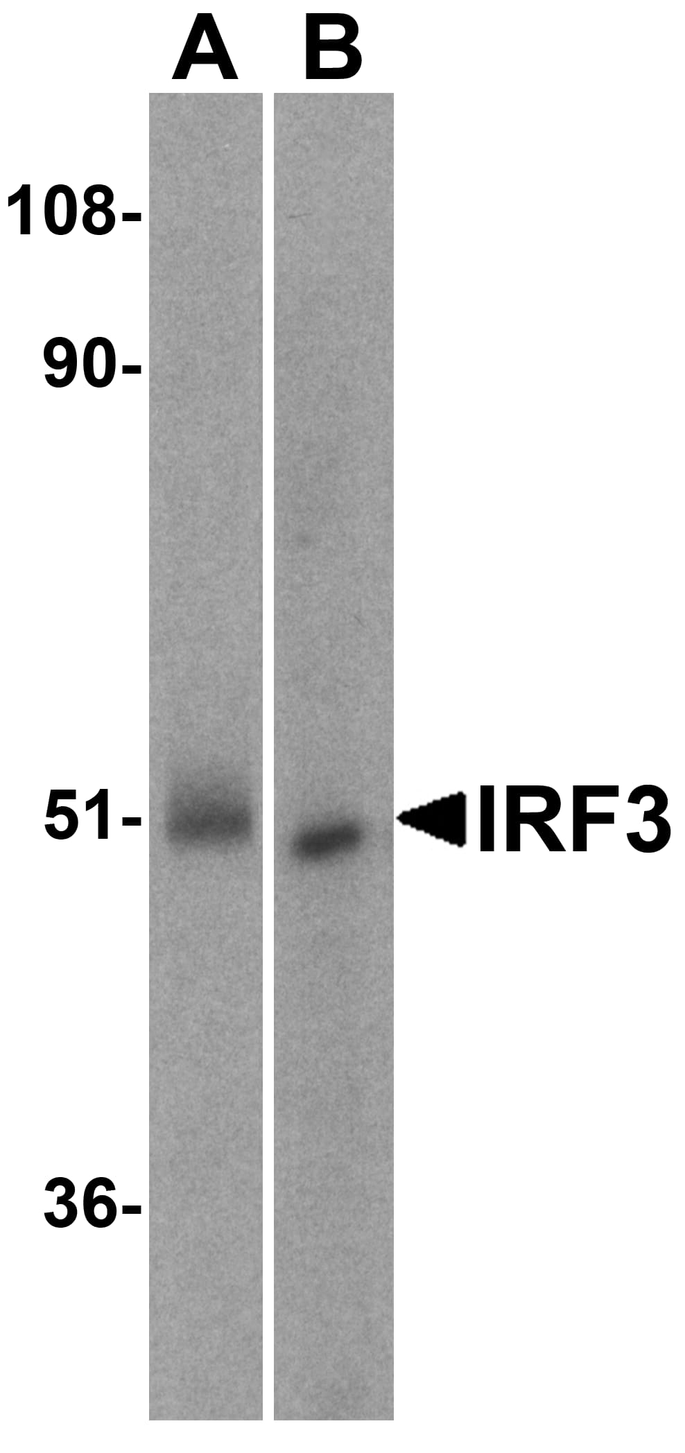 Western Blot: IRF3 Antibody - BSA Free [NBP1-76598] - Western blot analysis of IRF3 in (A) human kidney and (B) rat kidney lysate with IRF3 antibody at 1 u/mL..