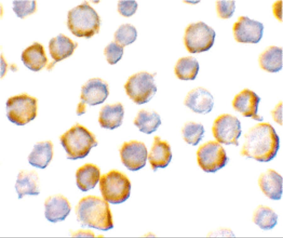 Immunocytochemistry/ Immunofluorescence: SIGIRR Antibody - BSA Free [NBP1-76599] - Immunocytochemistry of SIGIRR in A549 cells with SIGIRR antibody at 10 ug/mL.