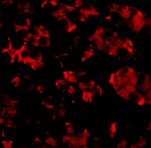 Immunocytochemistry/ Immunofluorescence: TRIM5 alpha Antibody - BSA Free [NBP1-76601] - Immunofluorescence of TRIM5 alpha in Human Stomach cells with TRIM5 alpha antibody at 10 u/mL.