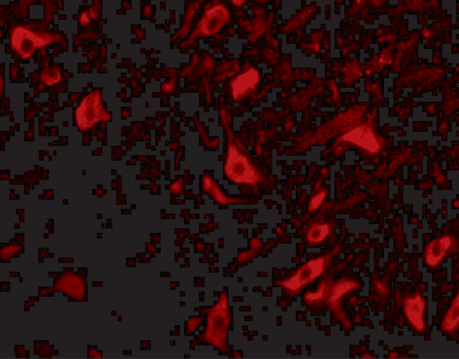 Immunocytochemistry/ Immunofluorescence: TRIM5 delta Antibody - BSA Free [NBP1-76603] - Immunofluorescence of TRIM5 delta in mouse brain tissue with TRIM5 delta antibody at 10 u/mL.