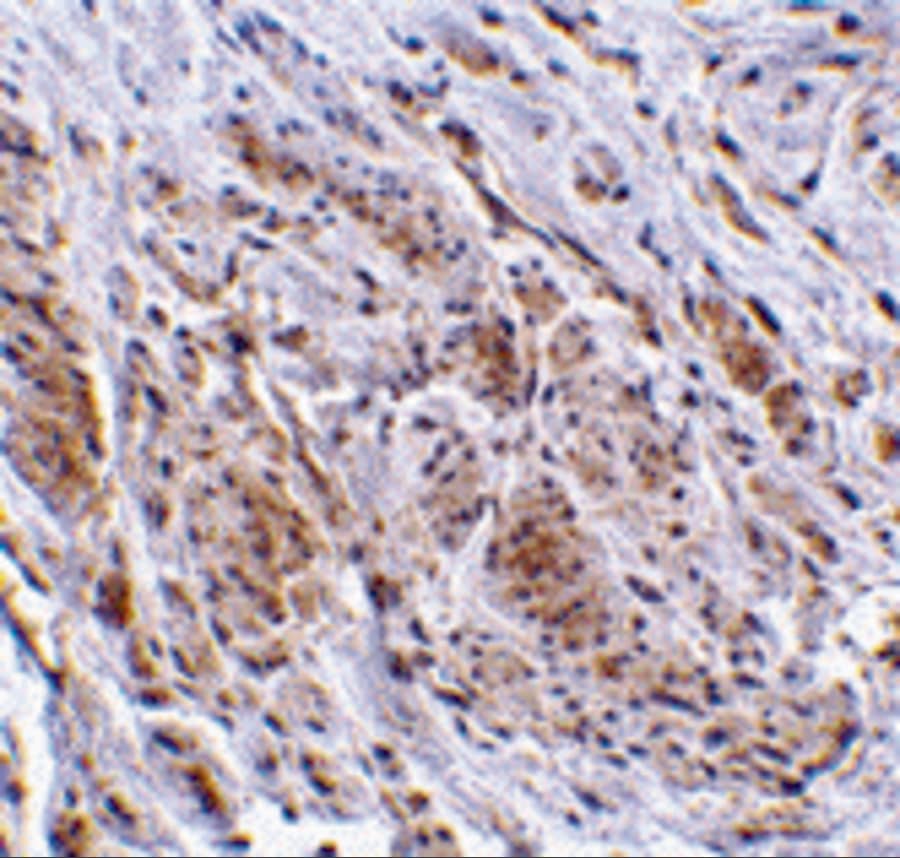 Immunohistochemistry: TRIM5 gamma Antibody - BSA Free [NBP1-76604] - Immunohistochemistry of TRIM5 gamma in human bladder tissue with TRIM5 gamma antibody at 2 u/mL.