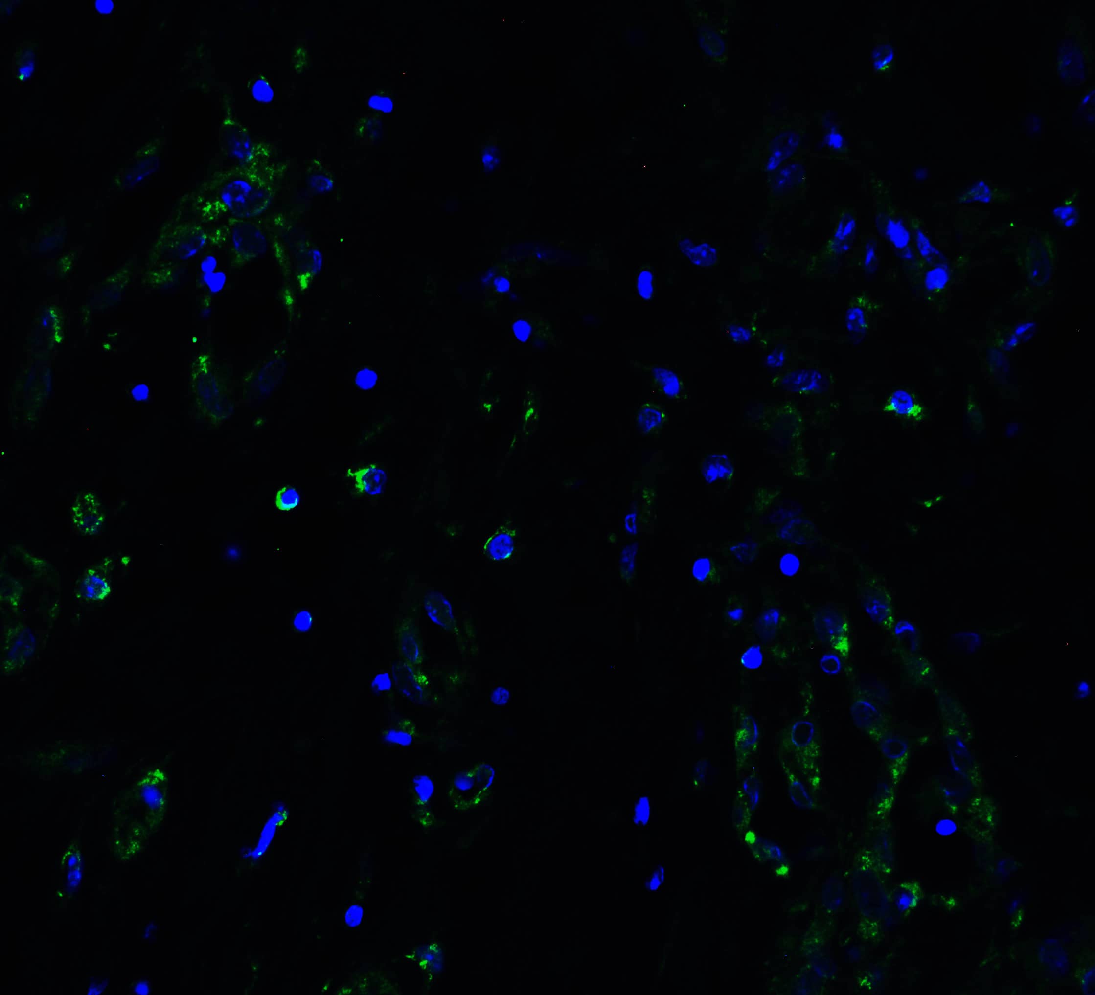 Immunocytochemistry/ Immunofluorescence: ACE-2 Antibody - BSA Free [NBP1-76611] - Validation of ACE-2 in Human Lung Tissue.Immunofluorescent analysis of 4% paraformaldehyde-fixed human lung tissue labeling ACE-2 at 20 ug/mL, followed by goat anti-rabbit IgG secondary antibody at 1/500 dilution (green) and DAPI staining (blue).