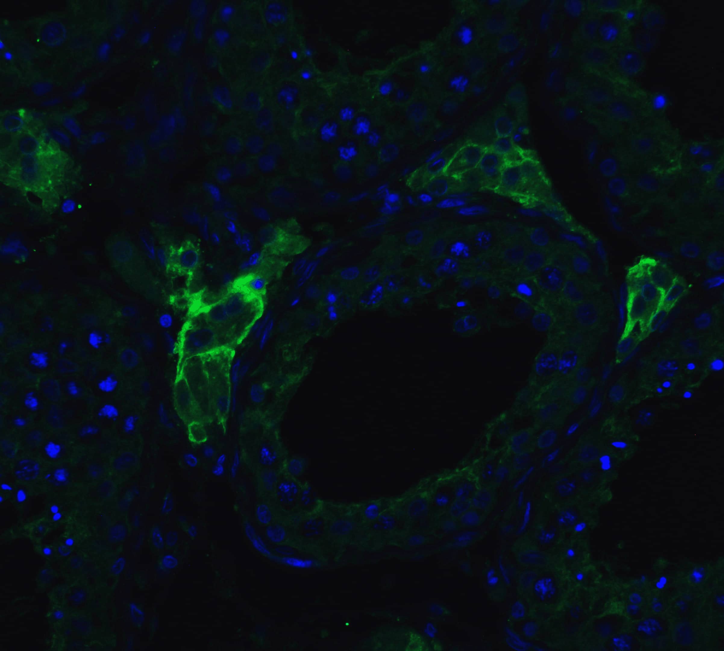 Immunocytochemistry/ Immunofluorescence: ACE-2 Antibody - BSA Free [NBP1-76611] - Validation of ACE-2 in Human Testis Tissue.Immunofluorescent analysis of 4% paraformaldehyde-fixed human testis tissue labeling ACE-2 with  at 20 ug/mL, followed by goat anti-rabbit IgG secondary antibody at 1/500 dilution (green) and DAPI staining (blue).