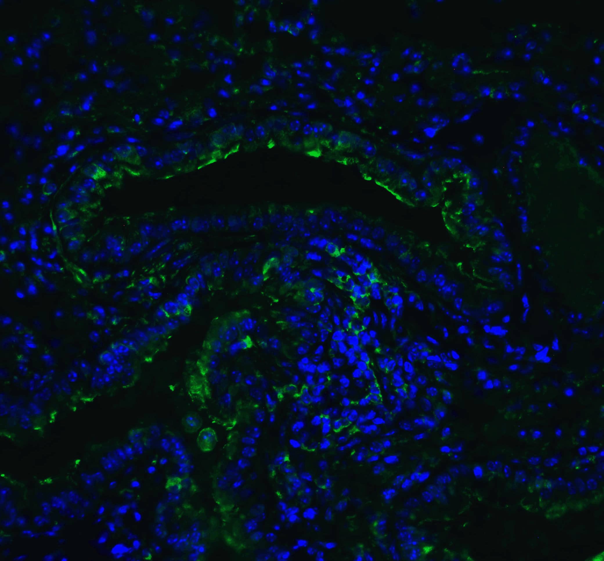 Immunocytochemistry/ Immunofluorescence: ACE-2 Antibody - BSA Free [NBP1-76611] - Validation of ACE-2 in Mouse Lung Tissue.Immunofluorescent analysis of 4% paraformaldehyde-fixed mouse lung tissue labeling ACE-2 at 20 ug/mL, followed by goat anti-rabbit IgG secondary antibody at 1/500 dilution (green) and DAPI staining (blue).