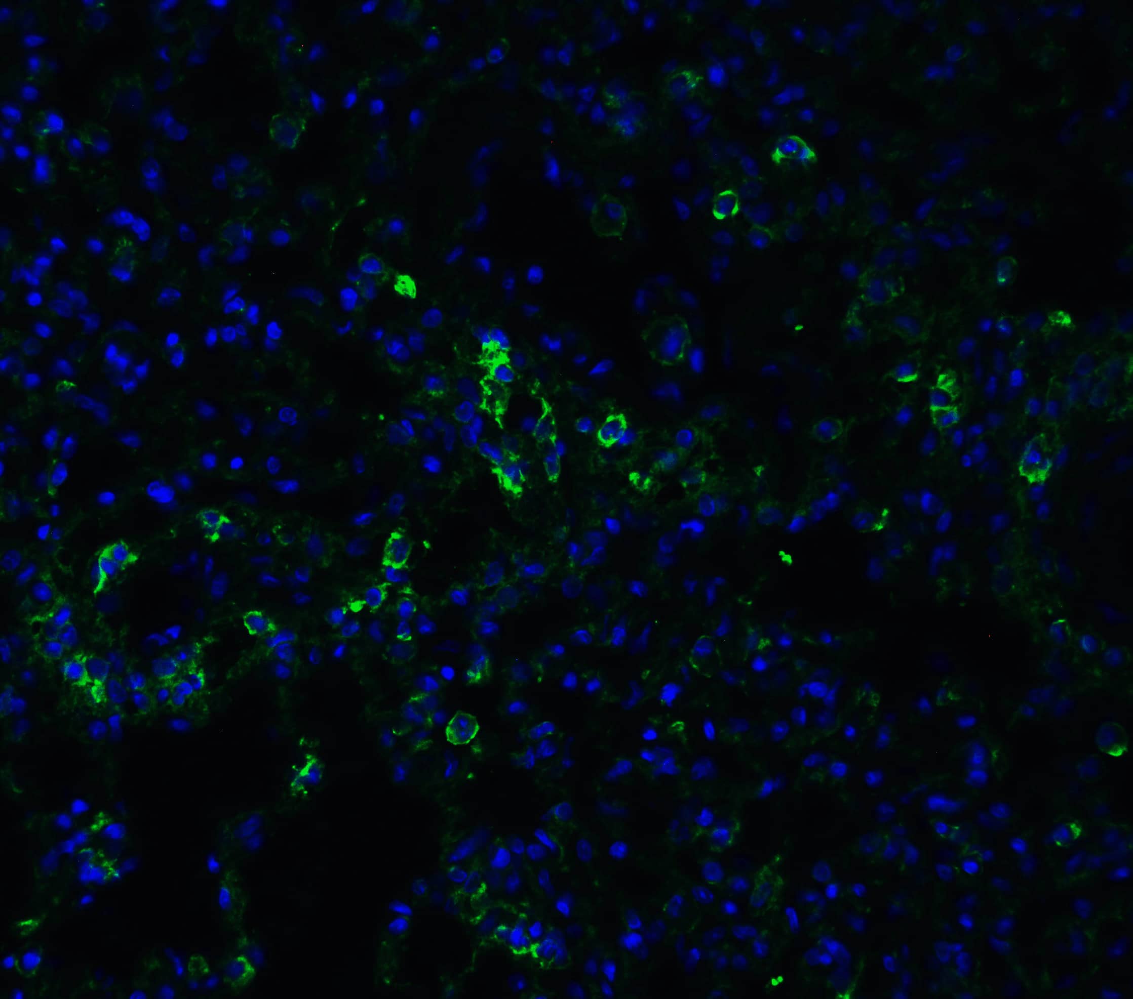 Immunocytochemistry/ Immunofluorescence: ACE-2 Antibody - BSA Free [NBP1-76611] - Validation of ACE-2 in Rat Lung Tissue.Immunofluorescent analysis of 4% paraformaldehyde-fixed rat lung tissue labeling ACE-2 with  at 20 ug/mL, followed by goat anti-rabbit IgG secondary antibody at 1/500 dilution (green) and DAPI staining (blue).