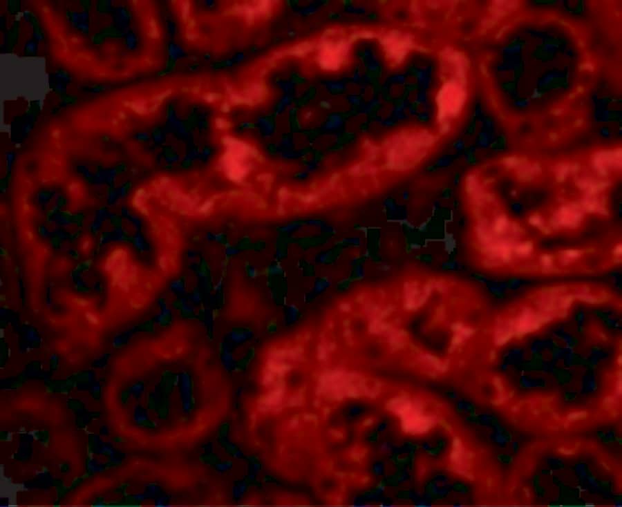 Immunocytochemistry/ Immunofluorescence: ACE-2 Antibody - BSA Free [NBP1-76611] - Validation of ACE-2 in Human Kidney Cells.Immunofluorescent analysis of 4% paraformaldehyde-fixed human kidney cells labeling ACE-2 at 10 ug/mL, followed by goat anti-rabbit IgG secondary antibody at 1/500 dilution (red).  