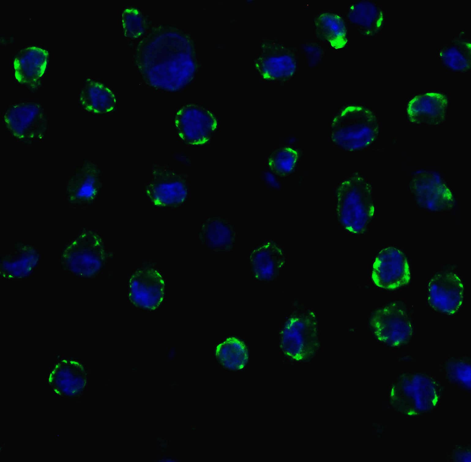 Immunocytochemistry/ Immunofluorescence: ACE-2 Antibody - BSA Free [NBP1-76611] - Validation of ACE-2 In Caco2 Cells.Immunofluorescent analysis of 4% paraformaldehyde-fixed Caco2 cells labeling ACE-2 with  at 20 ug/mL, followed by goat anti-rabbit IgG secondary antibody at 1/500 dilution (green) and DAPI staining (blue).  Image showing membrane staining on Caco2 cells. 