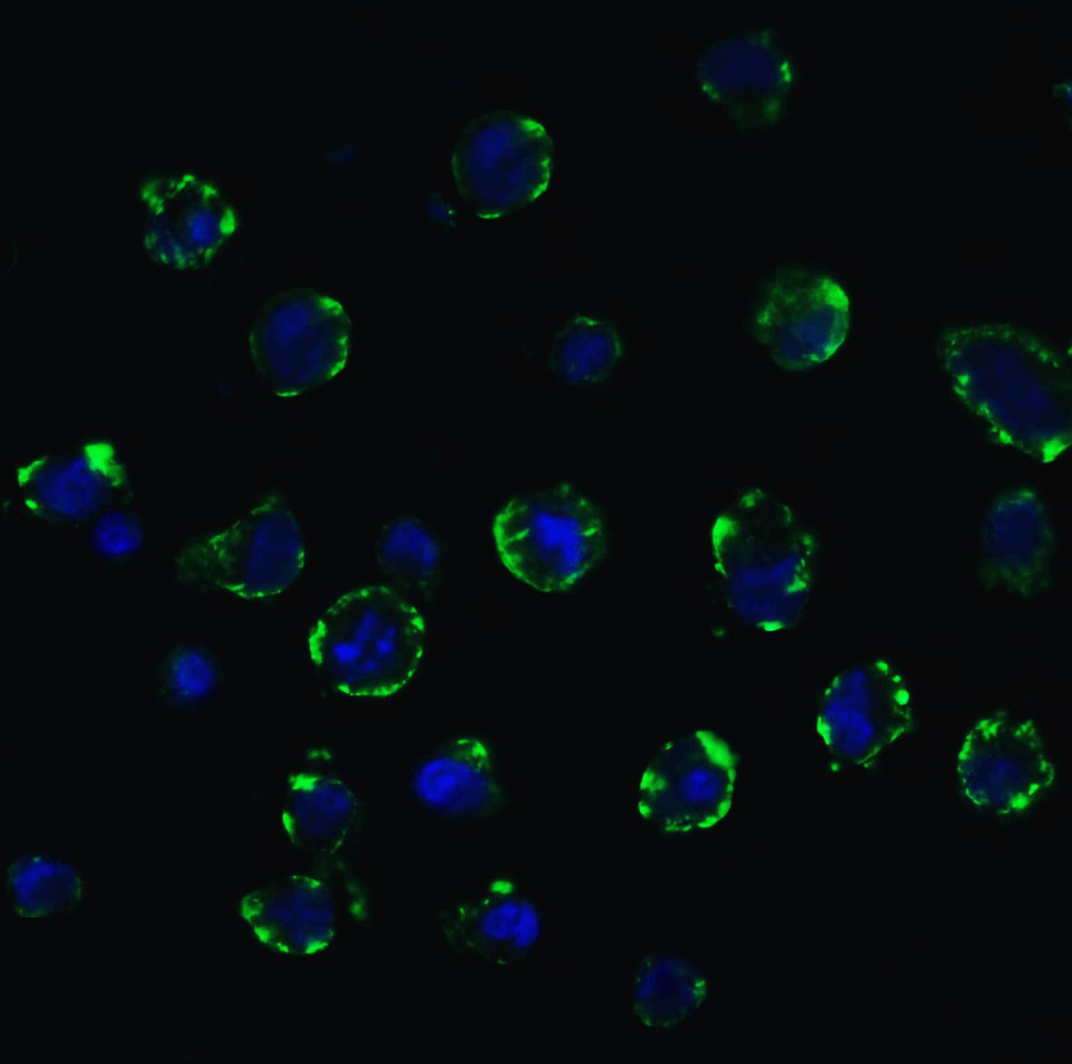 Immunocytochemistry/ Immunofluorescence: ACE-2 Antibody - BSA Free [NBP1-76614] - Figure 9 Immunofluorescence Validation of ACE-2 In Caco2 Cells   Immunofluorescent analysis of 4% paraformaldehyde-fixed Caco2 cells labeling ACE-2 with  at 20 ug/mL, followed by goat anti-rabbit IgG secondary antibody at 1/500 dilution (green) and DAPI staining (blue).  Image showing membrane staining on Caco2 cells. 