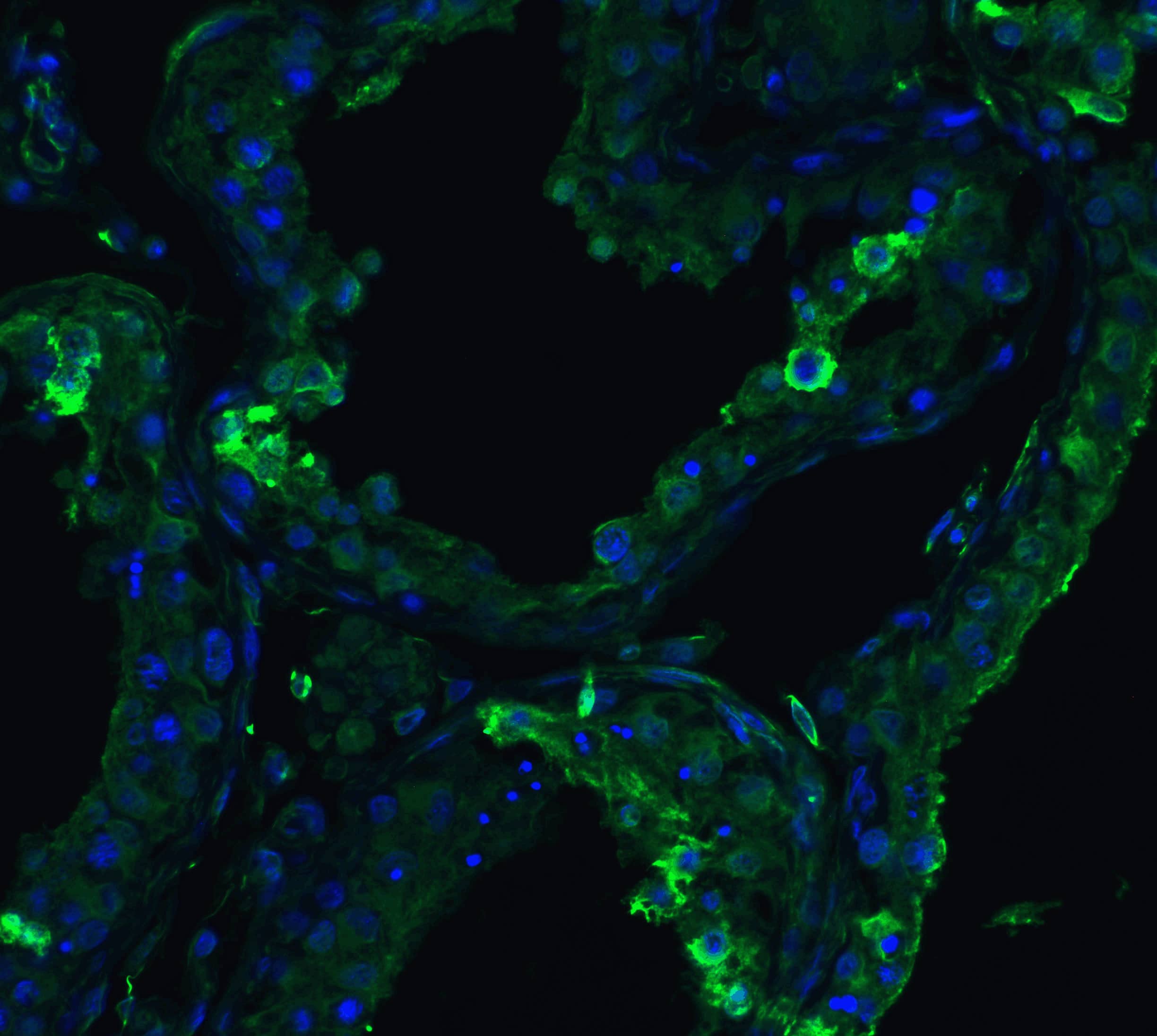 Immunocytochemistry/ Immunofluorescence: ACE-2 Antibody - BSA Free [NBP1-76614] - Figure 6 Immunofluorescence Validation of ACE-2 in Human Testis Tissue Immunofluorescent analysis of 4% paraformaldehyde-fixed human testis tissue labeling ACE-2 with  at 20 ug/mL, followed by goat anti-rabbit IgG secondary antibody at 1/500 dilution (green) and DAPI staining (blue).