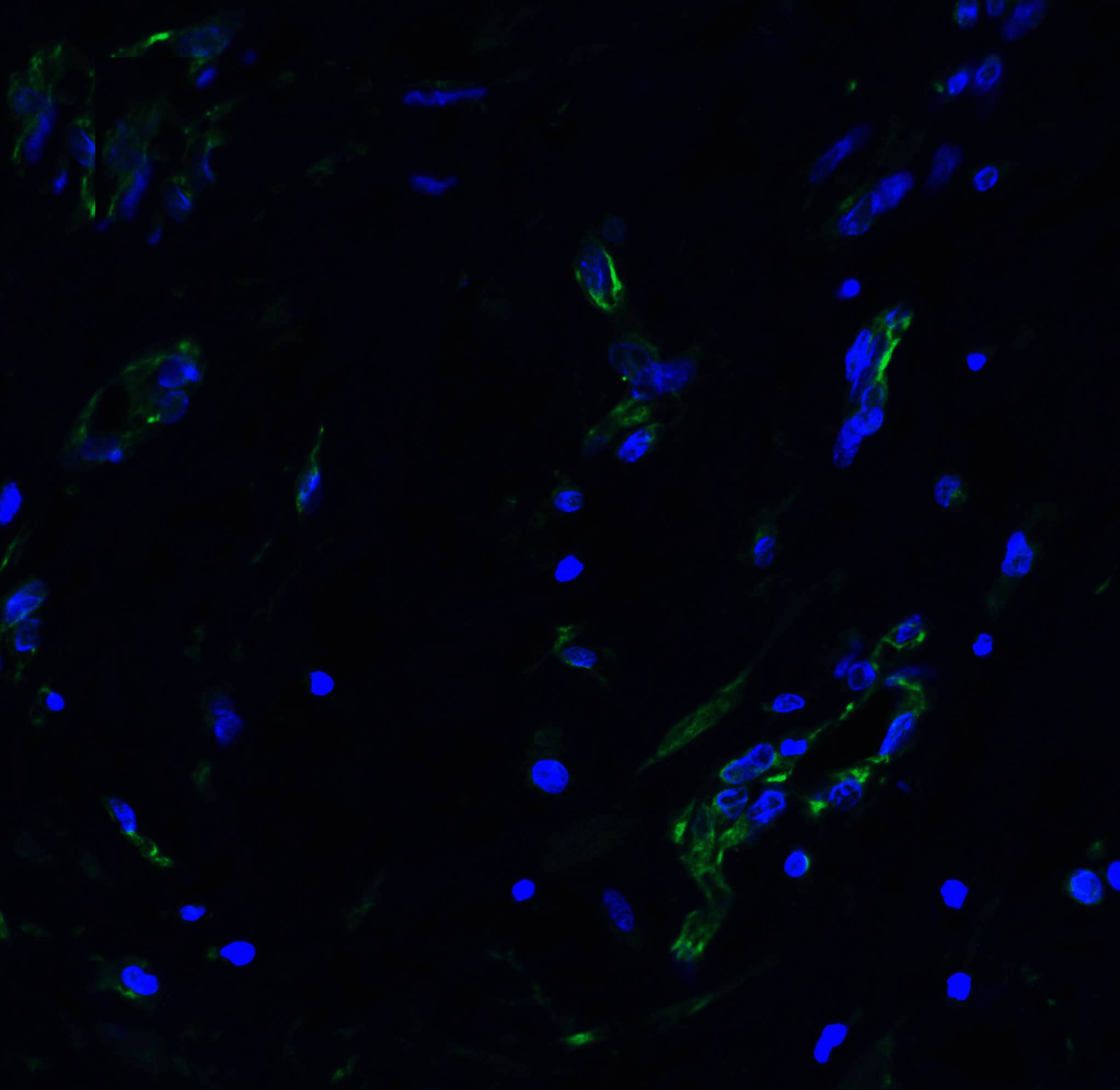 Immunocytochemistry/ Immunofluorescence: ACE-2 Antibody - BSA Free [NBP1-76614] - Figure 7 Immunofluorescence Validation of ACE-2 in Human Lung Tissue Immunofluorescent analysis of 4% paraformaldehyde-fixed human lung tissue labeling ACE-2 with  at 20 ug/mL, followed by goat anti-rabbit IgG secondary antibody at 1/500 dilution (green) and DAPI staining (blue).