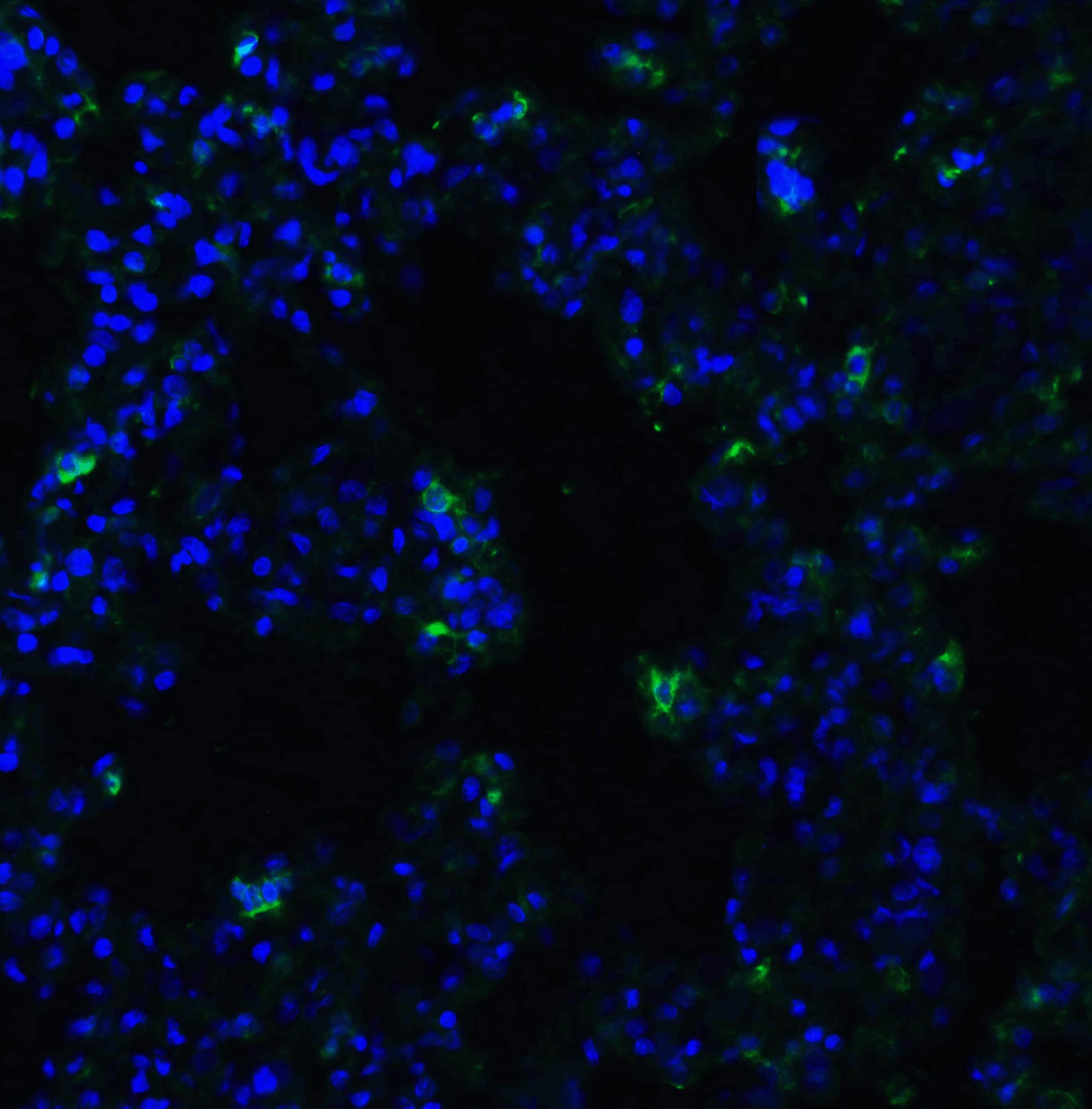 Immunocytochemistry/ Immunofluorescence: ACE-2 Antibody - BSA Free [NBP1-76614] - Figure 8 Immunofluorescence Validation of ACE-2 in Rat Lung Tissue Immunofluorescent analysis of 4% paraformaldehyde-fixed rat lung tissue labeling ACE-2 with  at 20 ug/mL, followed by goat anti-rabbit IgG secondary antibody at 1/500 dilution (green) and DAPI staining (blue).