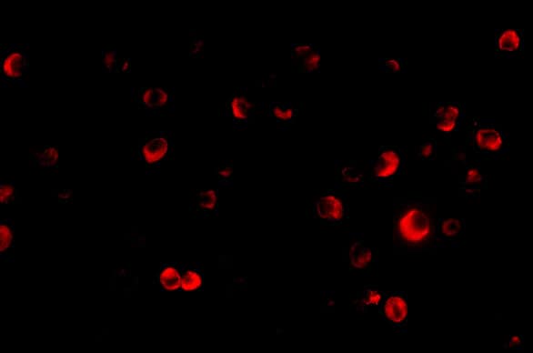 Immunocytochemistry/ Immunofluorescence: TSC2 Antibody - BSA Free [NBP1-76619] - Immunofluorescence of TSC2 in L1210 cells with TSC2 antibody at 20 ug/mL.