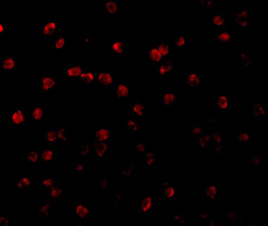 Immunocytochemistry/ Immunofluorescence: RSK1 Antibody - BSA Free [NBP1-76620] - Immunofluorescence of RP S6 Kinase in Jurkat cells with RP S6 Kinase antibody at 20 u/mL.