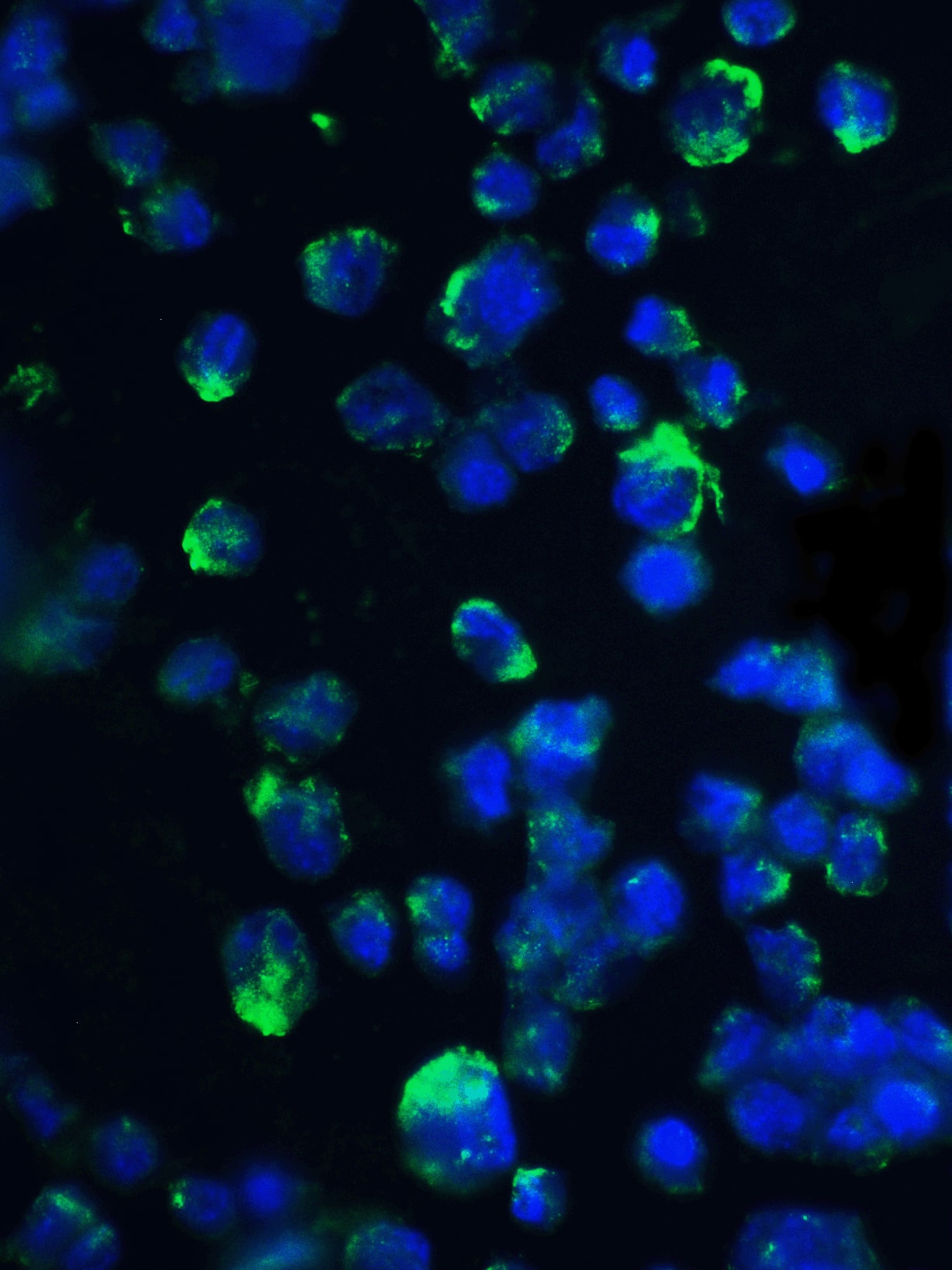 Immunocytochemistry/ Immunofluorescence: 4EBP1 Antibody - BSA Free [NBP1-76621] - Immunofluorescence of 4EBP1 in 3T3 cells with 4EBP1 antibody at 20 ug/ml.Green: 4EBP1 Antibody   Blue: DAPI staining