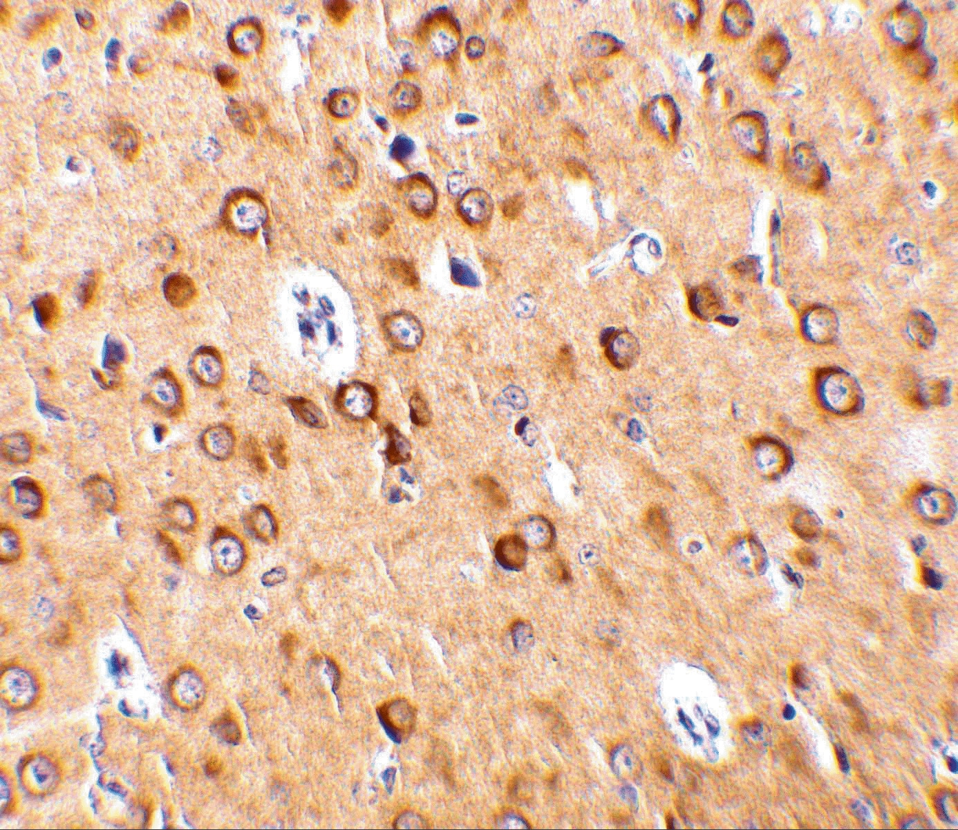 Immunohistochemistry: C1qTNF4/CTRP4 Antibody - BSA Free [NBP1-76629] - Immunohistochemistry of C1qTNF4/CTRP4 in rat brain with C1qTNF4/CTRP4 antibody at 10 u/mL.