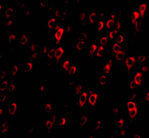 Immunocytochemistry/ Immunofluorescence: C1qTNF4/CTRP4 Antibody - BSA Free [NBP1-76629] - Immunofluorescence of C1qTNF4/CTRP4 in Rat Brain cells with C1qTNF4/CTRP4 antibody at 20 ug/mL.