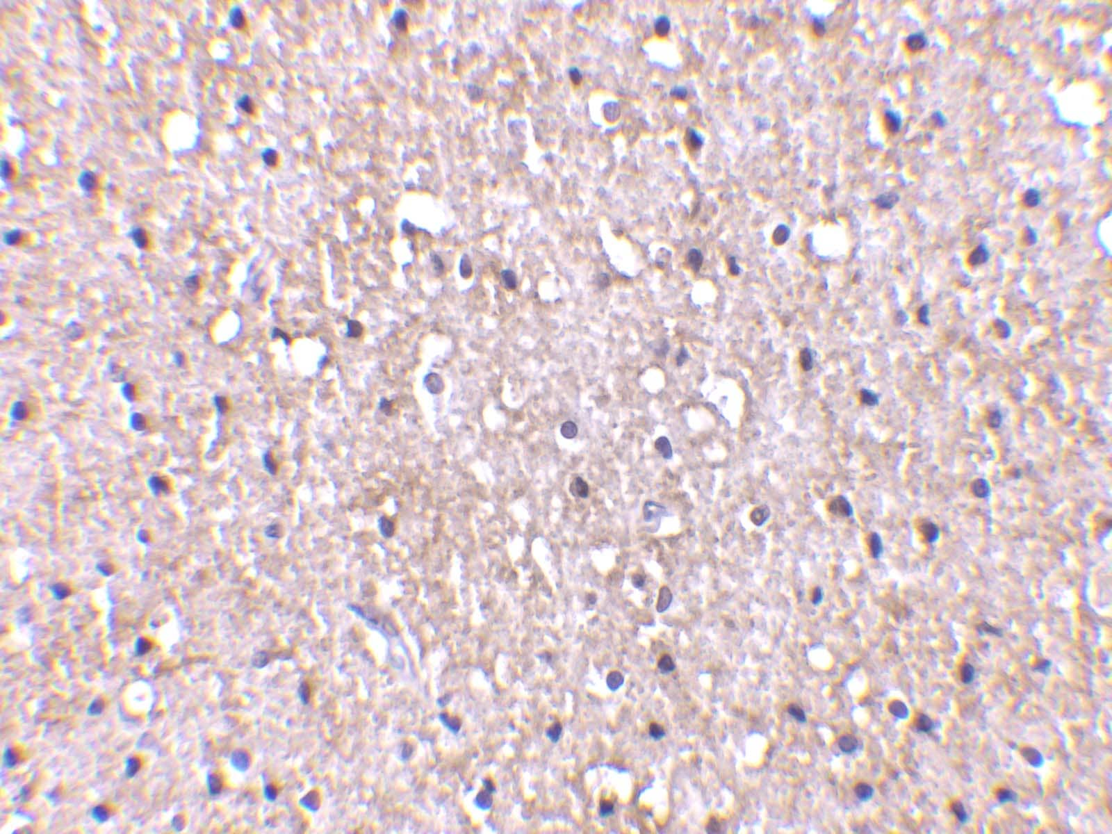 Immunohistochemistry: C1qTNF5/CTRP5 Antibody - BSA Free [NBP1-76631] - Immunohistochemistry of C1qTNF5/CTRP5 in human brain tissue with C1qTNF5/CTRP5 antibody at 10 ug/mL.