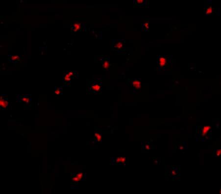 Immunocytochemistry/ Immunofluorescence: PAK6 Antibody - BSA Free [NBP1-76632] - Immunofluorescence of PAK6 in Raji cells with PAK6 antibody at 10 ug/mL.