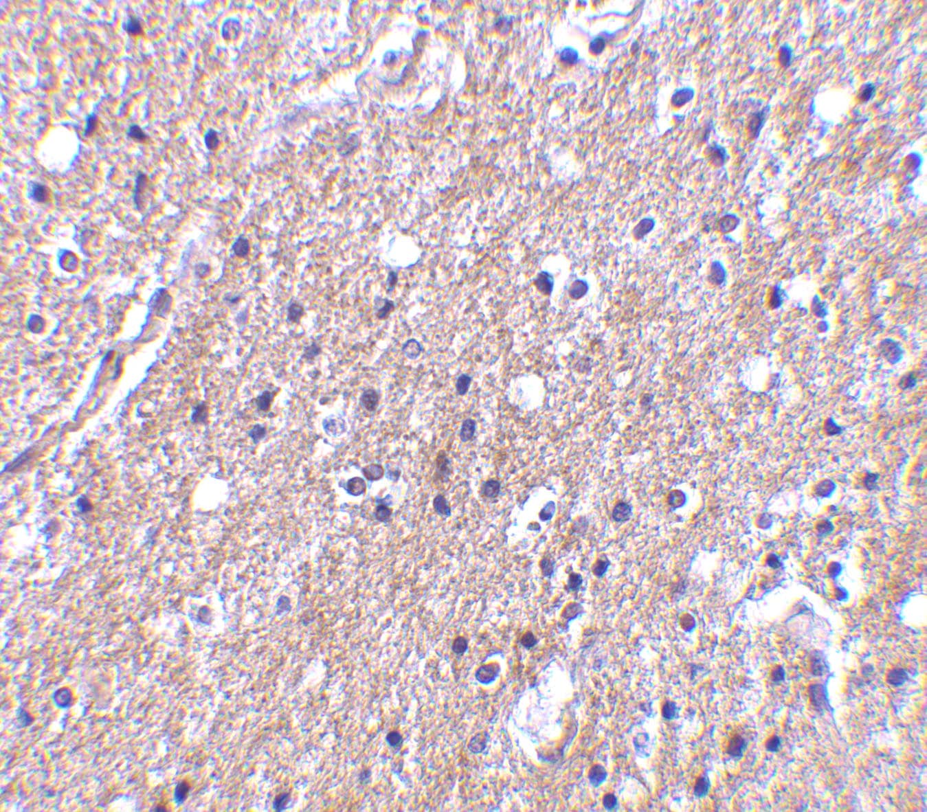 Immunohistochemistry CTRP6 Antibody - BSA Free