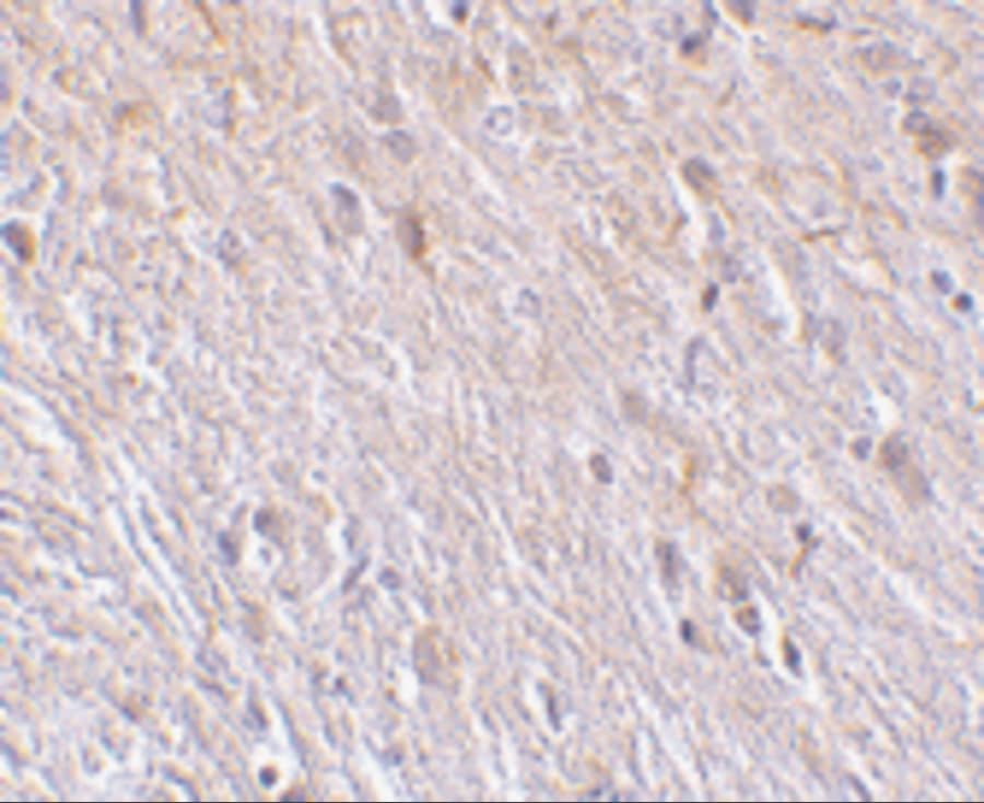 Immunohistochemistry: TTC5 Antibody - BSA Free [NBP1-76636] - Immunohistochemistry of TTC5 in mouse brain tissue with TTC5 antibody at 10 u/mL.