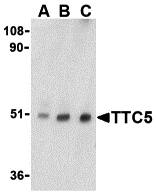 Western Blot: TTC5 Antibody - BSA Free [NBP1-76636] - Western blot analysis of TTC5 in RAW264.7 cell lysate with TTC5 antibody at (A) 0.5, (B) 1 and (C) 2 u/mL. 