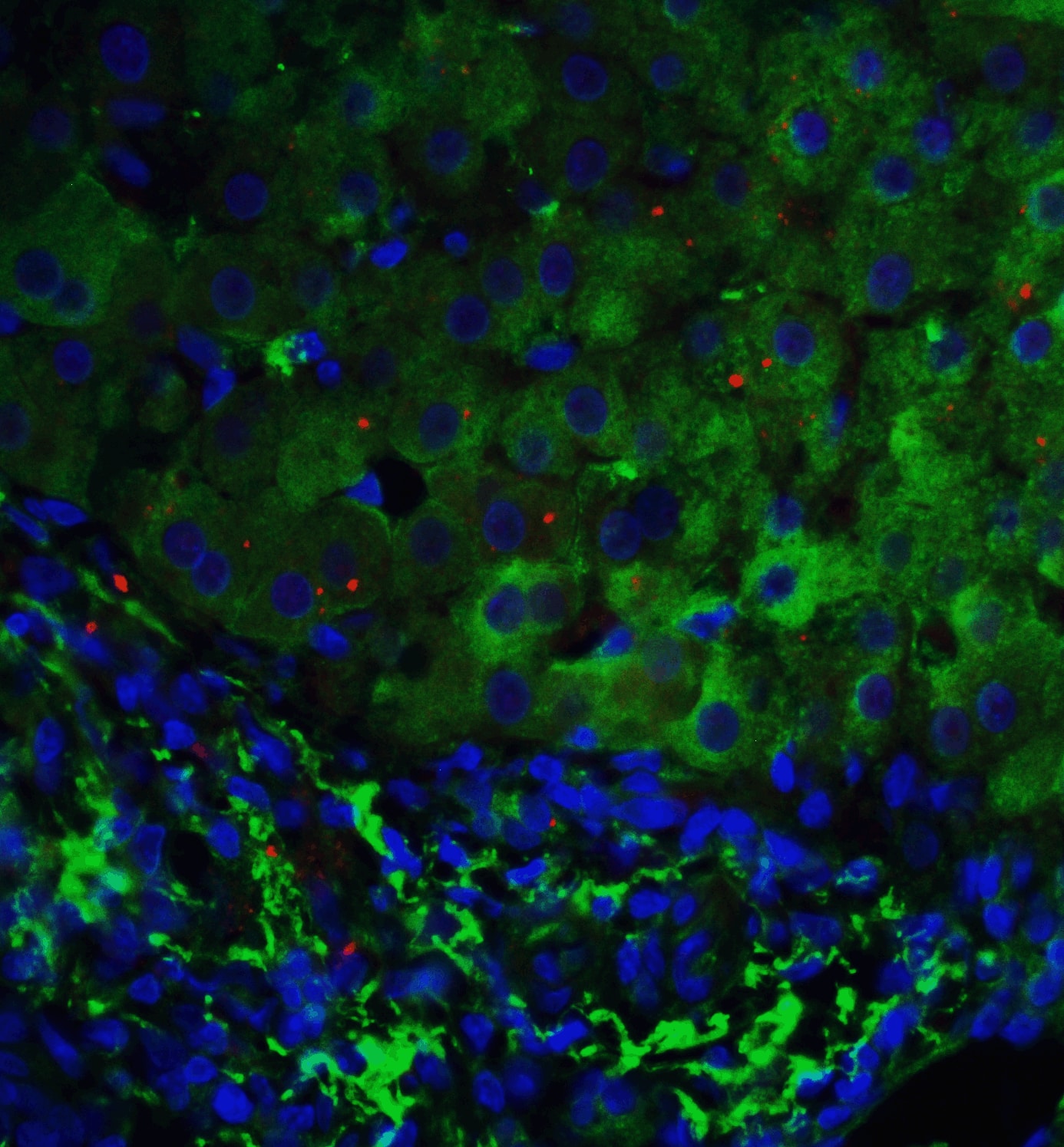 Immunocytochemistry/ Immunofluorescence p53 DINP1 Antibody - BSA Free