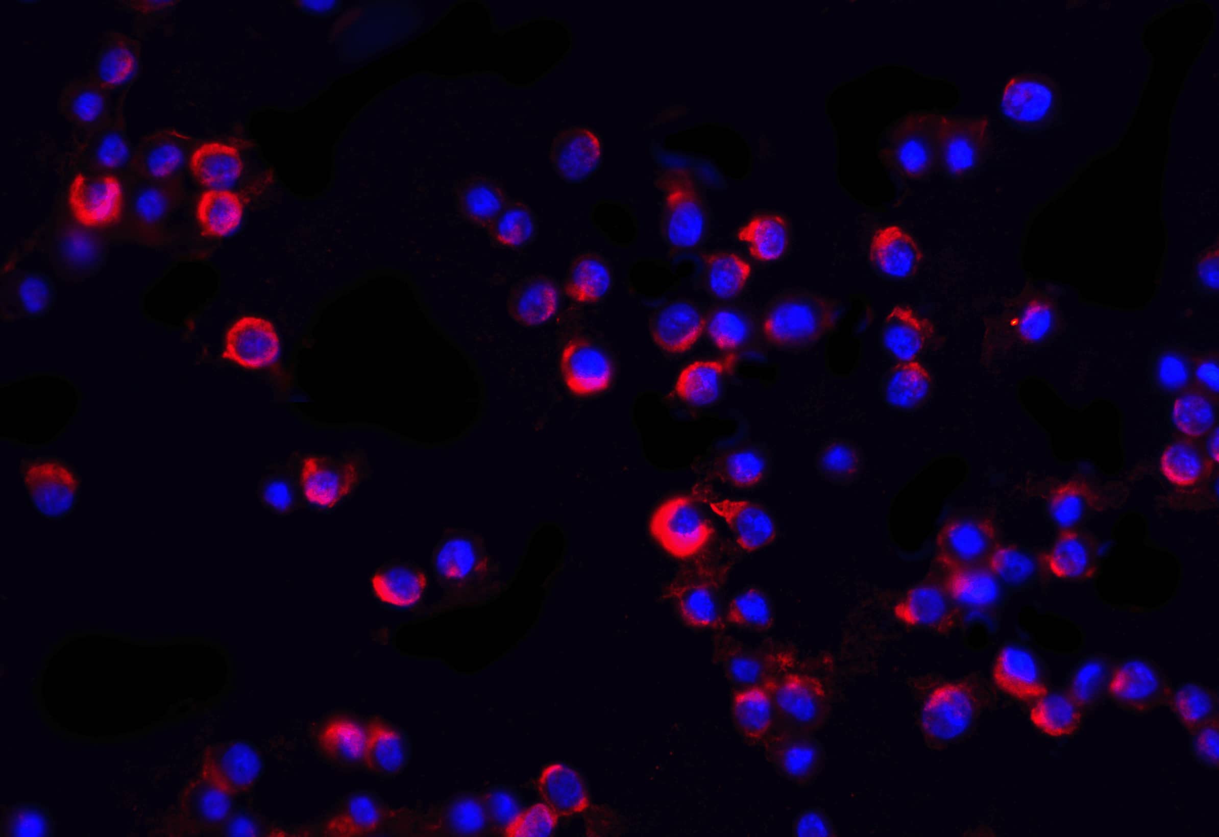 Immunocytochemistry/ Immunofluorescence: IRAK2 Antibody - BSA Free [NBP1-76641] - Immunofluorescence of IRAK2 in Hela cells with IRAK 2 antibody at 20 ug/mL.Red: IRAK2 Antibody   Blue: DAPI staining