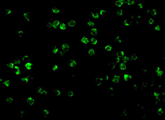 Immunocytochemistry/ Immunofluorescence: IRAK2 Antibody - BSA Free [NBP1-76641] - Immunofluorescence of IRAK2 in A20 cells with IRAK2 antibody at 10 ug/mL.