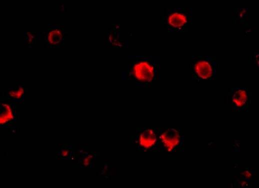 Immunocytochemistry/ Immunofluorescence: GRG (Groucho homolog) Antibody - BSA Free [NBP1-76646] - Immunofluorescence of GRG (Groucho homolog) in 293 cells with GRG (Groucho homolog) antibody at 20 ug/mL.