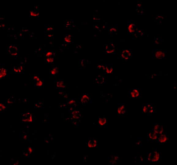 Immunocytochemistry/ Immunofluorescence: ATG7 Antibody - BSA Free [NBP1-76649] - Immunofluorescence of ATG7 in MCF7 cells with ATG7 antibody at 20 u/mL.