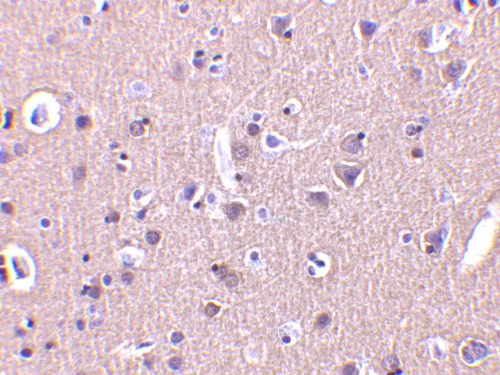 Immunohistochemistry CRMP1 Antibody - BSA Free