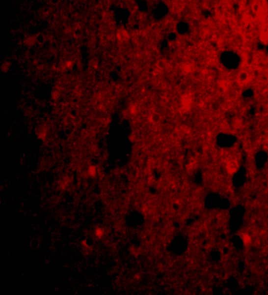 Immunocytochemistry/ Immunofluorescence: CRMP1 Antibody - BSA Free [NBP1-76652] - Immunofluorescence of CRMP1 in Human Brain cells with CRMP1 antibody at 20 ug/mL.