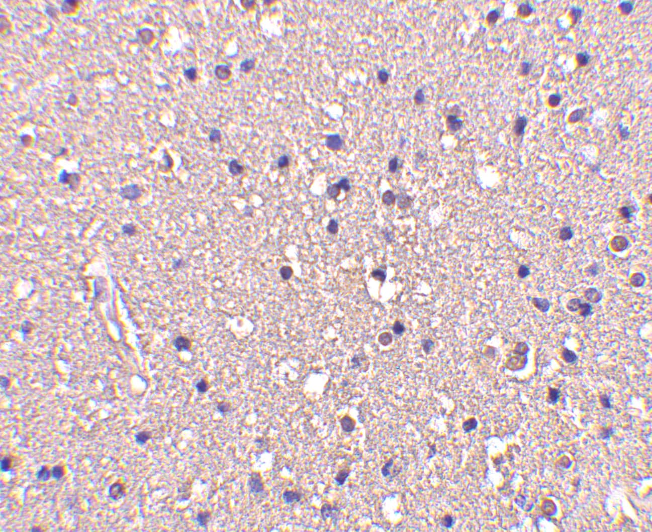 Immunohistochemistry: CRMP1 Antibody - BSA Free [NBP1-76652] - Immunohistochemistry of CRMP1 in human brain tissue with CRMP1 antibody at 10 ug/mL.