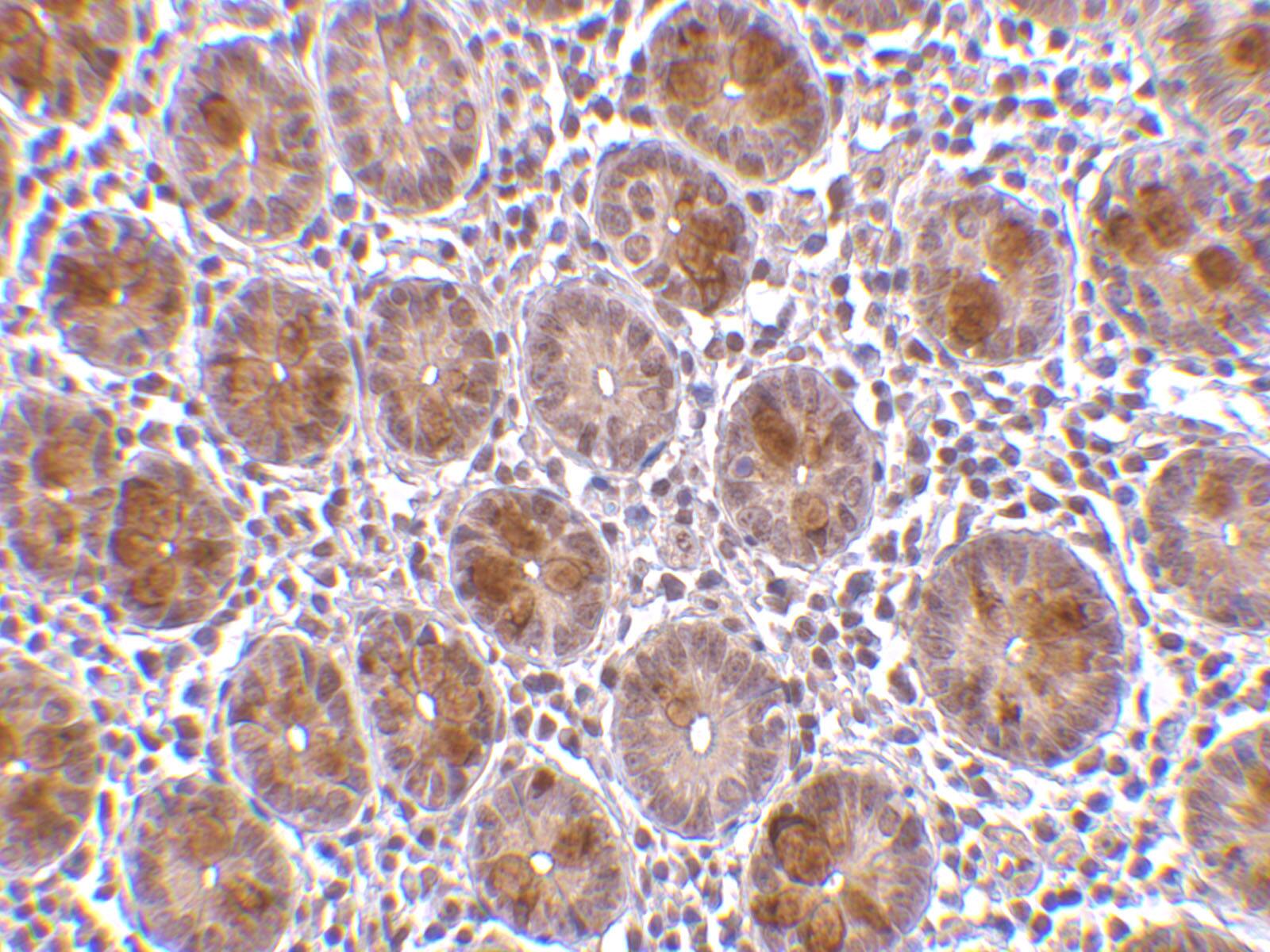 Immunohistochemistry AATF Antibody - BSA Free