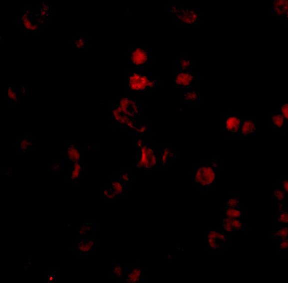 Immunocytochemistry/ Immunofluorescence AATF Antibody - BSA Free