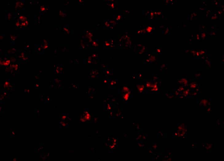 Immunocytochemistry/ Immunofluorescence: NLRP1/NALP1 Antibody - BSA Free [NBP1-76656] - Immunofluorescence of NLRP1/NALP1 in K562 cells with NLRP1/NALP1 antibody at 20 ug/mL.