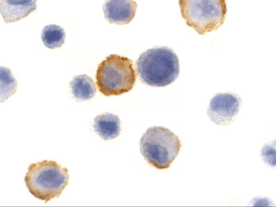 Immunocytochemistry/ Immunofluorescence: Bmf Antibody - BSA Free [NBP1-76658] - Immunocytochemistry of Bmf in HeLa cells with Bmf antibody at 10 ug/mL.