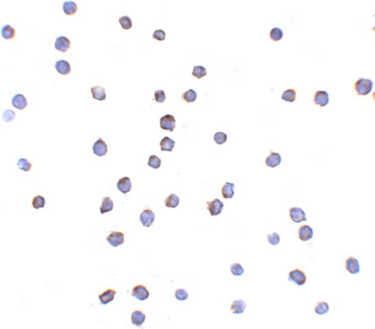 Immunocytochemistry/ Immunofluorescence: TLR6 Antibody - BSA Free [NBP1-76664] - Immunocytochemistry of TLR6 in Jurkat cells with TLR6 antibody at 2 ug/mL.