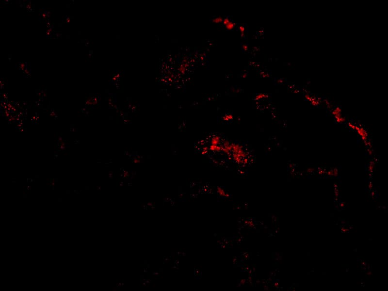 Immunocytochemistry/ Immunofluorescence: Septin-4 Antibody - BSA Free [NBP1-76667] - Immunofluorescence of Septin-4 in Human Lung cells with Septin-4 antibody at 20 ug/mL.