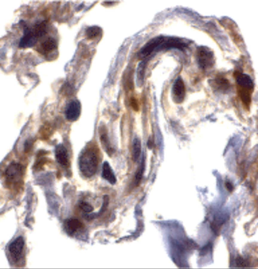 Immunohistochemistry: Septin-4 Antibody - BSA Free [NBP1-76667] - Immunohistochemistry of Septin-4 in human lung tissue with Septin-4 antibody at 2 u/mL.