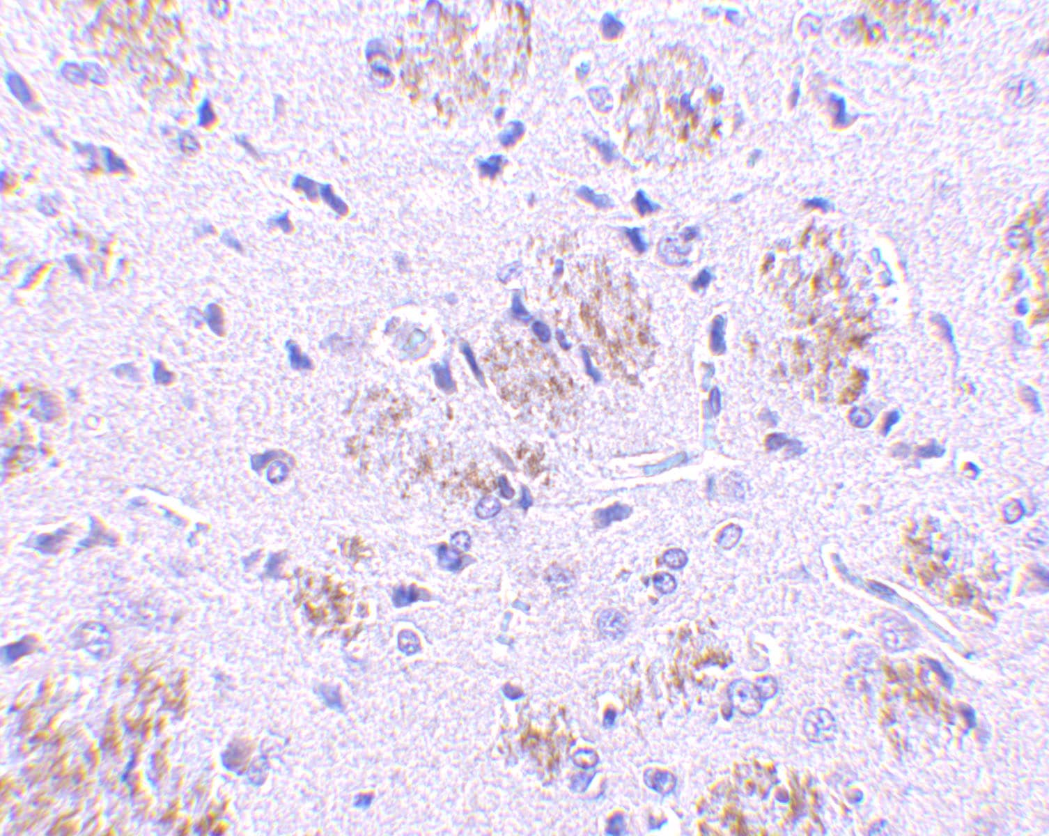 Immunohistochemistry KLHL1 Antibody - BSA Free