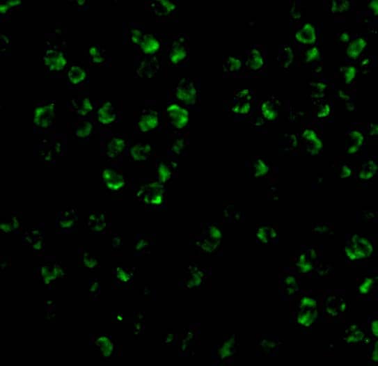 Immunocytochemistry/ Immunofluorescence: ASK1 Antibody - BSA Free [NBP1-76674] - Immunofluorescence of ASK1 in 3T3 cells with ASK1 antibody at 20 ug/mL.