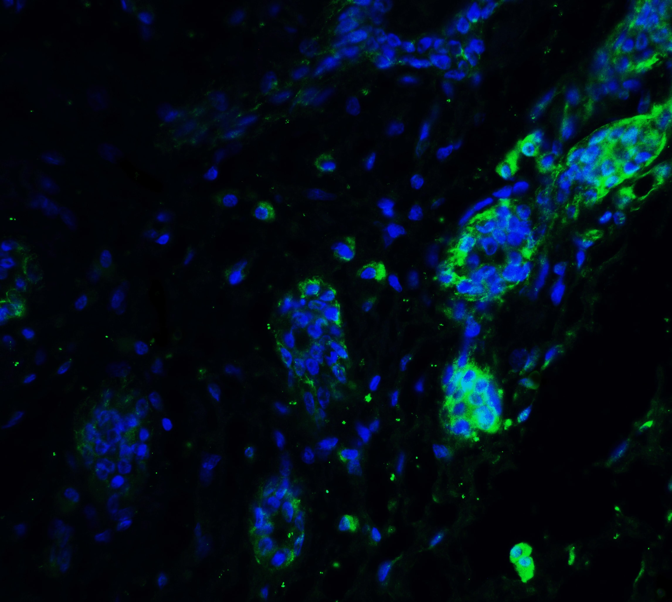 Immunocytochemistry/ Immunofluorescence: ATF6 Antibody - BSA Free [NBP1-76675] - Immunofluorescence of ATF6 in human breast tissue with ATF6 antibody at 20 u/ml.Green: ATF6 Antibody   Blue: DAPI staining